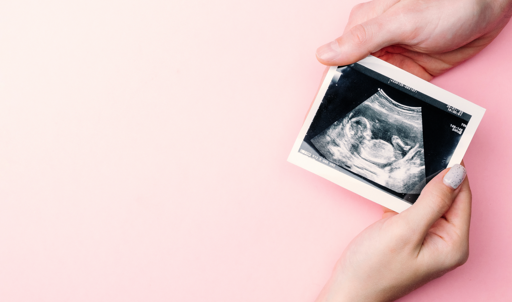 Pregnancy ultrasound scan at 15 weeks