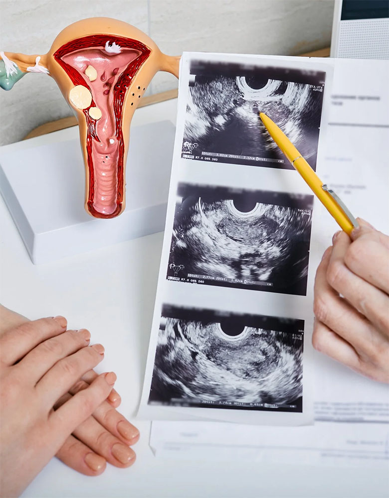 Fertility consultation and assessment