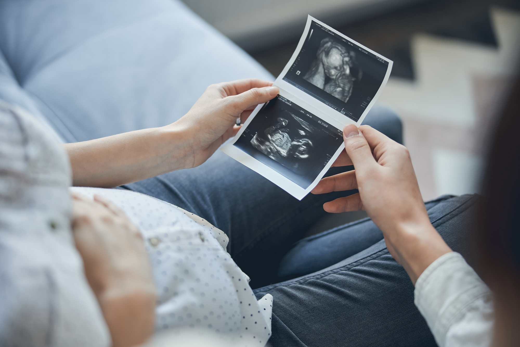 First ultrasound picture of a baby