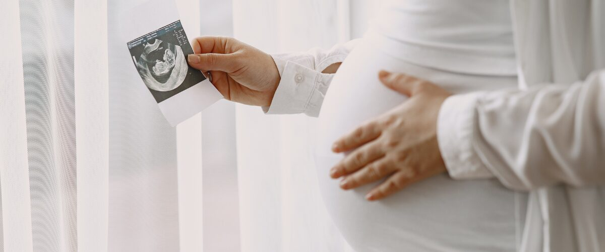 Pregnant woman holding ultrasound scan